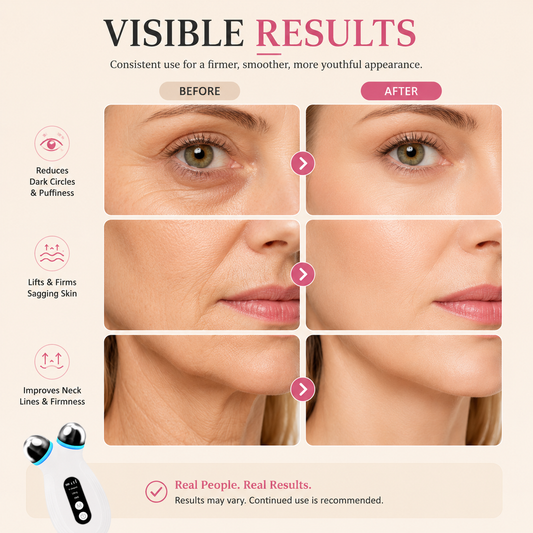 Microcurrent Face Lift Device — V-Shape Jawline & EMS Skin Toning
