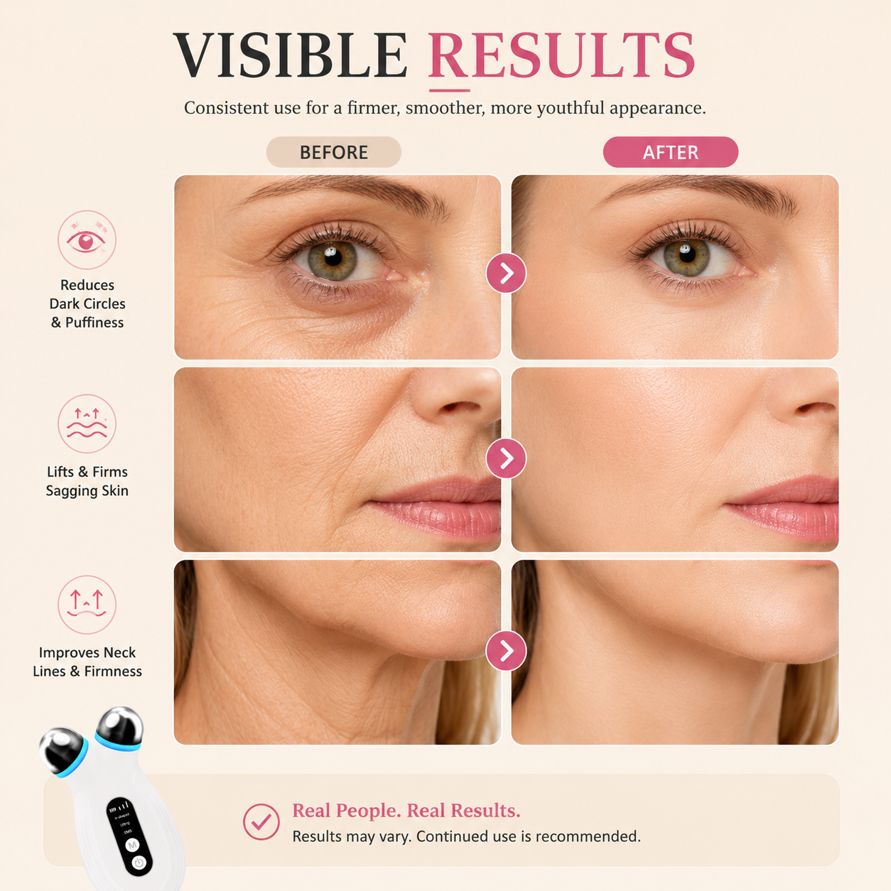 Microcurrent Face Lift Device — V-Shape Jawline & EMS Skin Toning